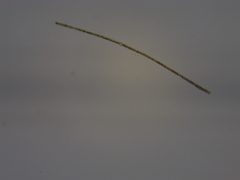 Dolichospermum planctonicum