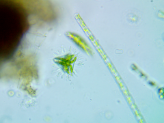 Staurastrum avicula lunatum