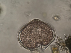 Protoperidinium