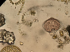 Protoperidinium