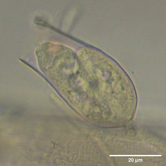 Vaginicolidae
