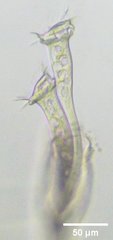 Vaginicolidae