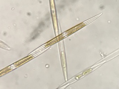 Pseudo-nitzschia