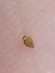 Eleocharis tenuis verrucosa