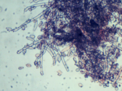Botryobasidium conspersum