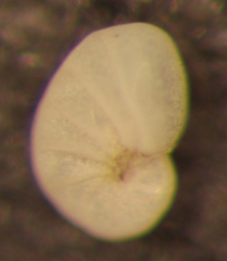 Nonionella basispinata