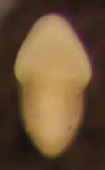 Elphidiella hannai