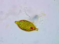 Trachelomonas hexangulata