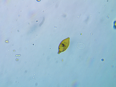 Trachelomonas hexangulata