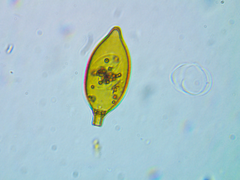 Trachelomonas hexangulata