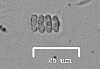 Scenedesmus