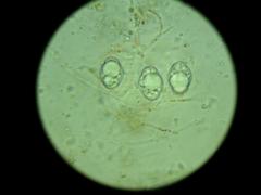 Pulvinula archeri