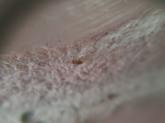 Dasydemellidae