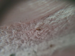 Dasydemellidae