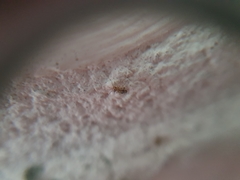 Dasydemellidae
