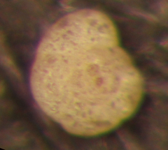 Trochammina pacifica