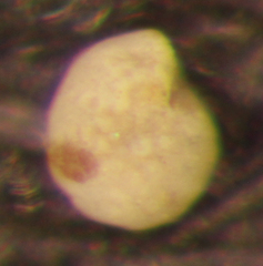 Elphidium gunteri