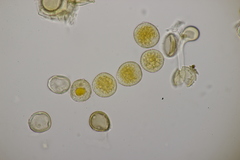 Puccinia brachypodii