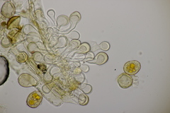 Puccinia brachypodii