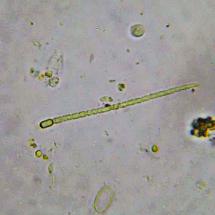 Anabaena torulosa