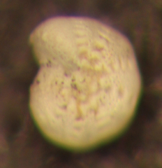 Elphidium gunteri