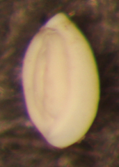 Quinqueloculina
