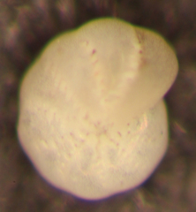 Elphidium excavatum