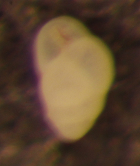 Bulimina denudata