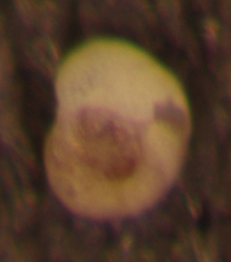 Rotorbinella campanulata