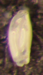 Quinqueloculina