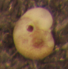 Rotorbinella campanulata