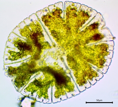 Micrasterias denticulata