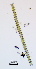 Triploceras gracile