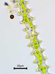 Triploceras gracile