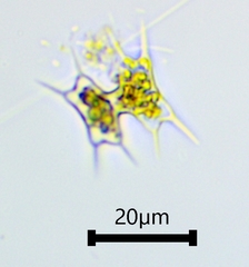 Staurodesmus octocornis