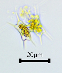Staurodesmus octocornis