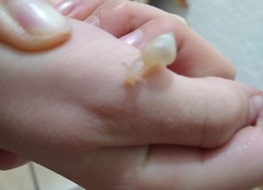 Gastropoda