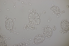Pseudomicrostroma juglandis