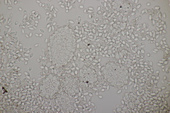 Pseudomicrostroma juglandis