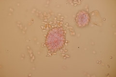 Pseudomicrostroma juglandis