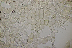 Puccinia veronicae
