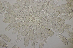 Puccinia veronicae
