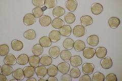 Puccinia maculosa