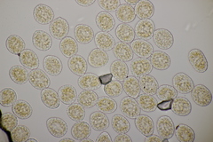 Pucciniastrum epilobii