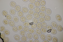 Pucciniastrum epilobii