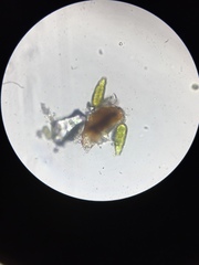 Echiniscidae