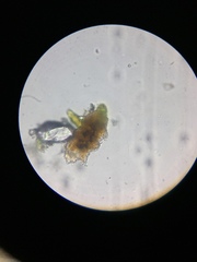 Echiniscidae