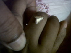Lepidoptera