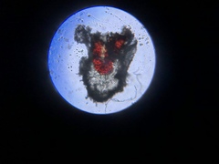 Alphapapillomavirus