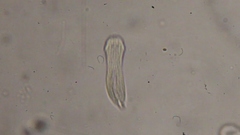 Gastrotricha